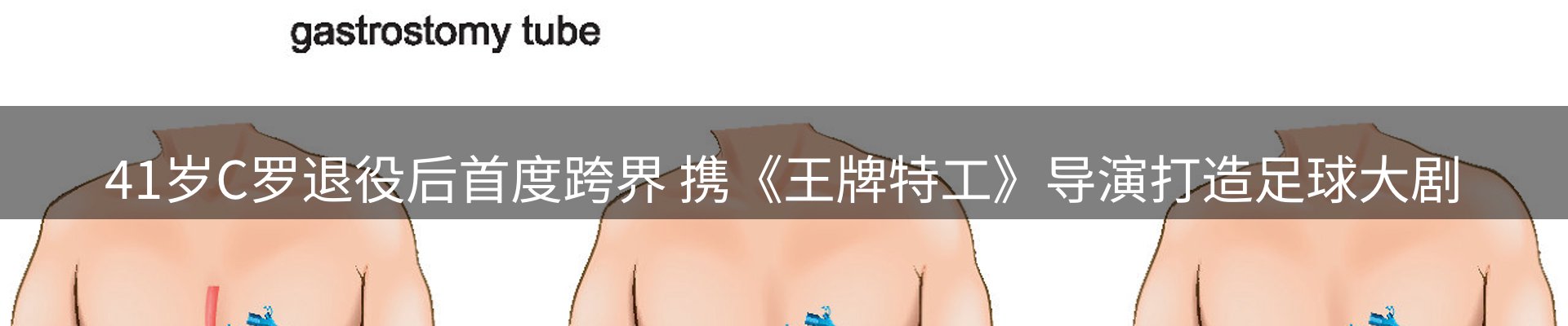 赛事资讯